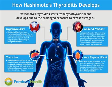 palm beach thyroid|Hashimoto’s Disease & Thyroid Hormone Treatment In Palm。